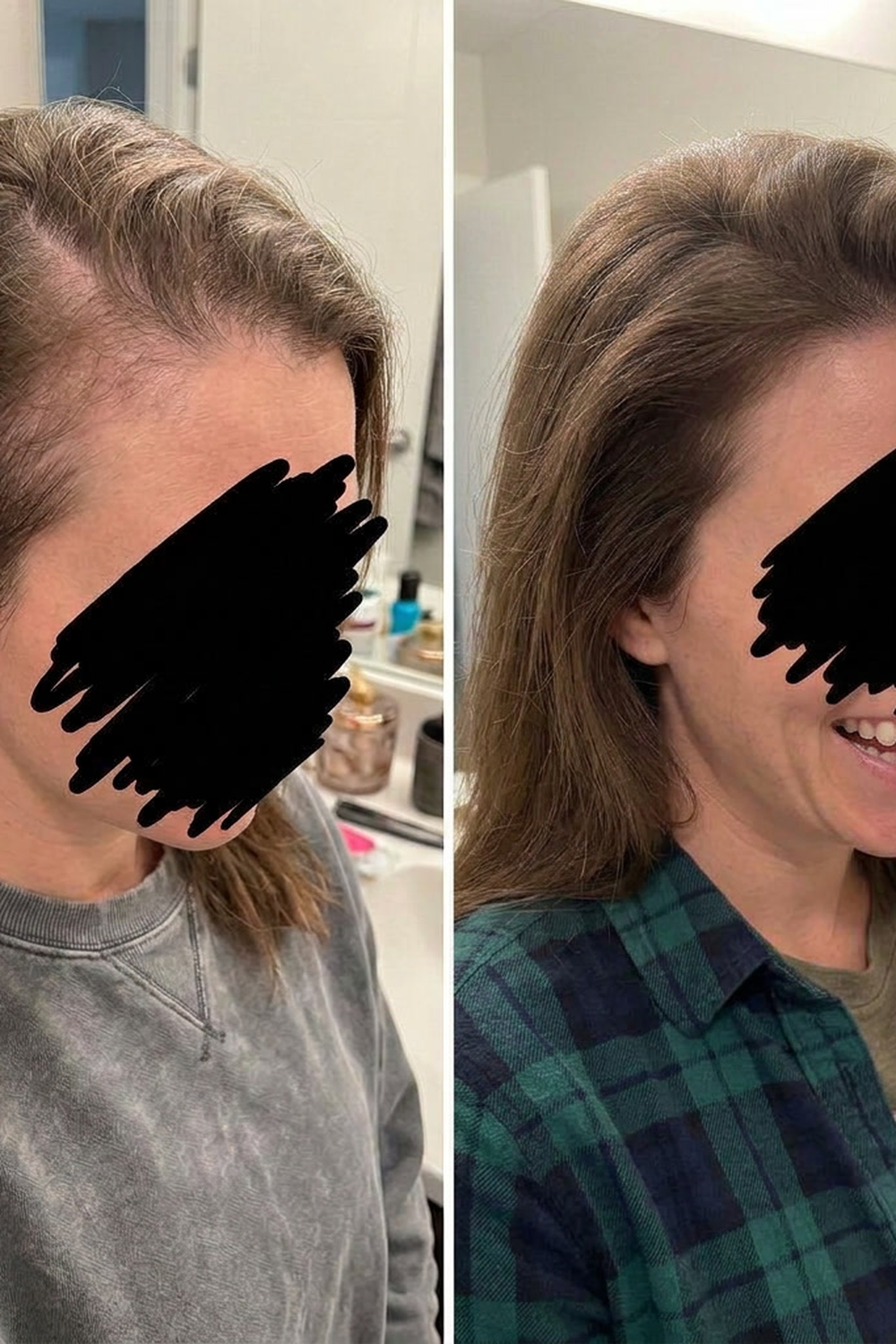 Before and after a hair topper on fine hair