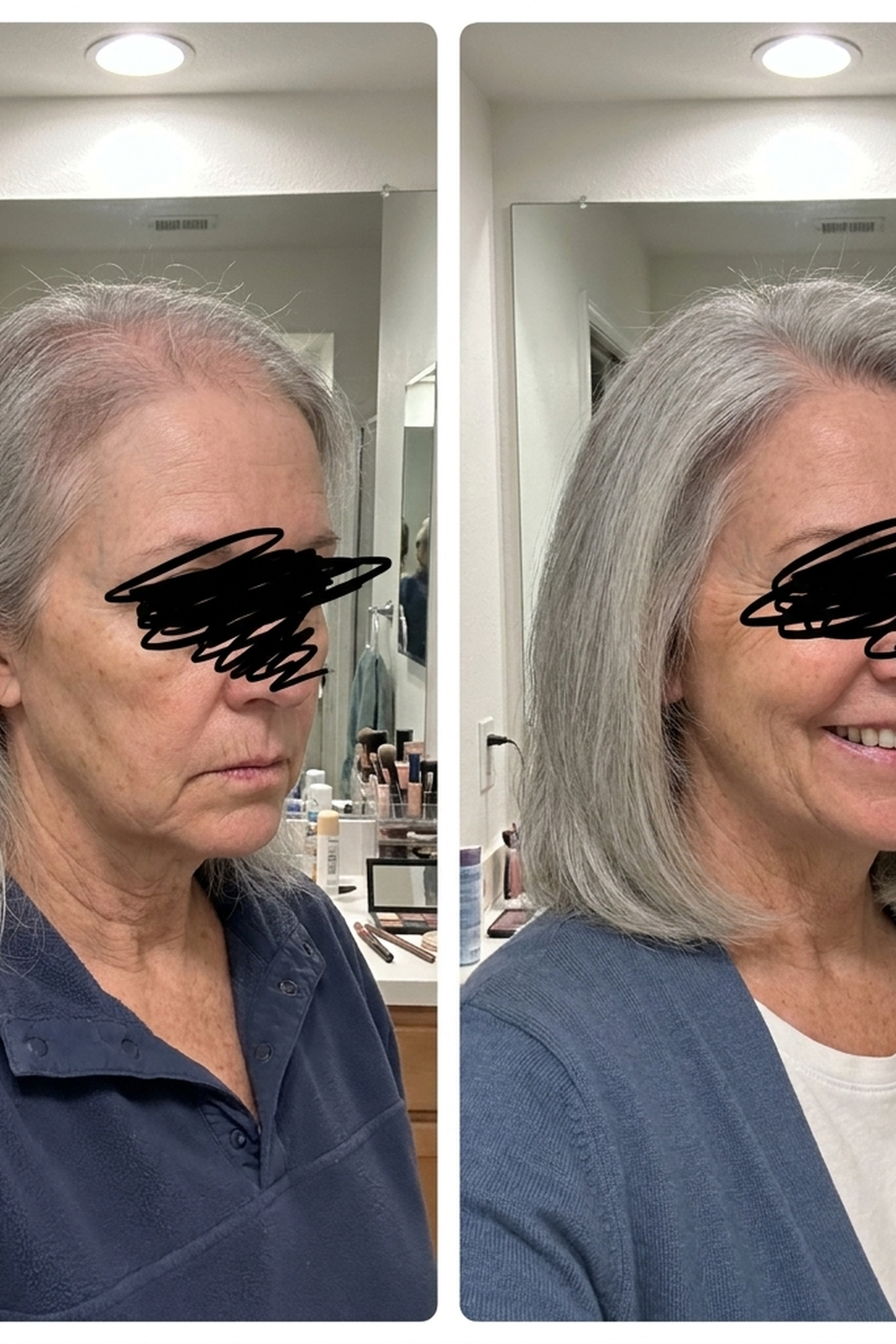 Before and after a hair topper on a thinning crown